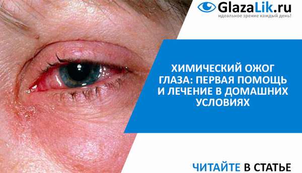 лечение химического ожога глаз